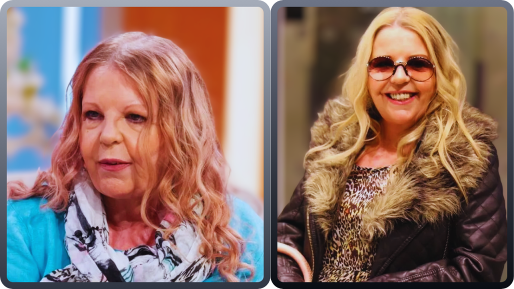 sally thomsett face illness